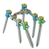 Sequoia® Pedicle Screw System