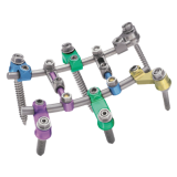 ST360°® Spinal Fixation System